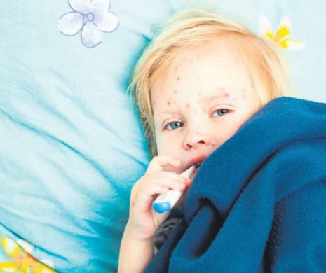 Explozie de cazuri de rujeolă! Medicii spun că nu au vaccinuri
