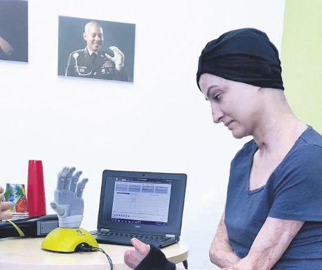 La aproape un an de la tragedia din „Colectiv”, Mariana Oprea învață, zi de zi, să ducă o viață normală. „Azi a fost super! M-am jucat cu o mână bionică, am încheiat nasturi, am pus apă în pahar!”