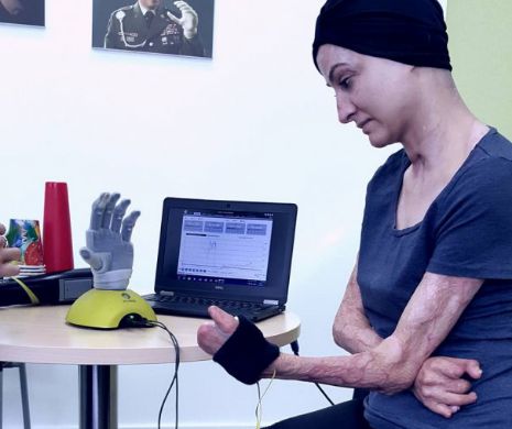 Tragedia din „Colectiv”! Mărturii emoționante: „Azi a fost super! M-am jucat cu o mână bionică, am încheiat nasturi, am pus apă în pahar!”