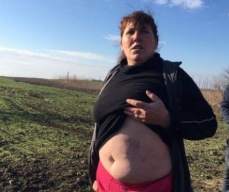 Pistolarul din Dolj!  Două persoane au fost împuşcate. "A tras în noi fără milă. A vrut să ne omoare“