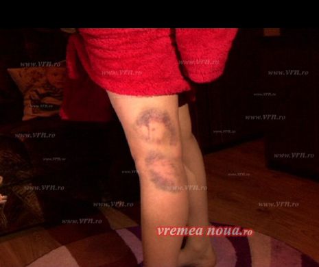 VASLUI. Un elev de 12 ani și-a bătut profesoara cu o țeavă de pexal, că ia dat cinci la teză