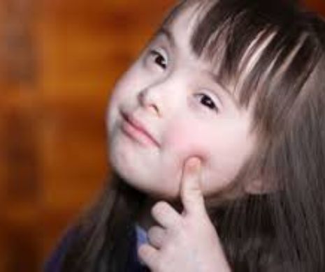 Copiii diagnosticați cu sindromul Down vor beneficia de însoțitor