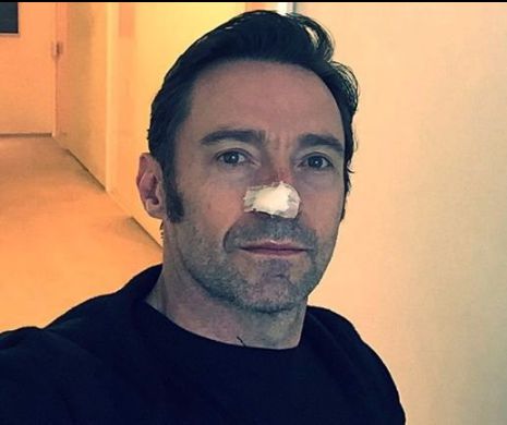 Veşti proaste despre celebrul Hugh Jackman. Actorul a ajuns din nou pe masa de operaţie
