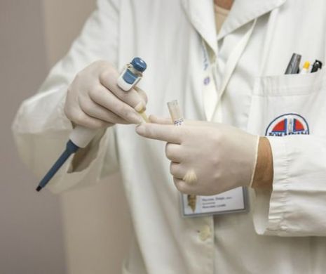 Boala lui Addison se produce la toate grupele de vârstă și afectează atât bărbații, cât și femeile. Boala lui Addison poate pune viața în pericol.