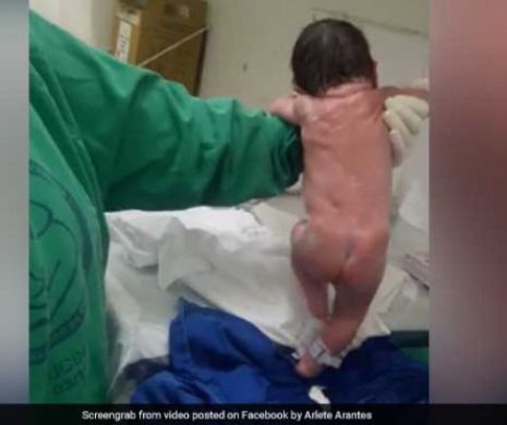Acuzații grave la adresa unui medic pediatru. A scăpat nou-născutul în cap