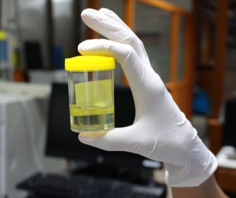 Din ce cauze apare lipsa urinării!