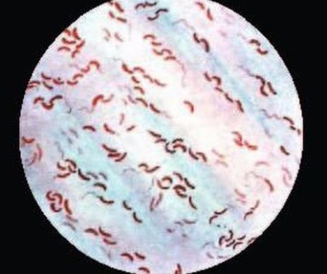Epidemia de holeră care a ÎNSPĂIMÎNTAT lumea! Peste 200.000 de cazuri într-o singură țară