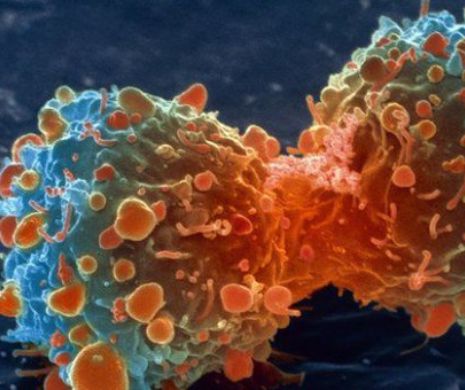 Peste 11 milioane de euro pentru găsirea de tratamente inovatoare pentru cancer