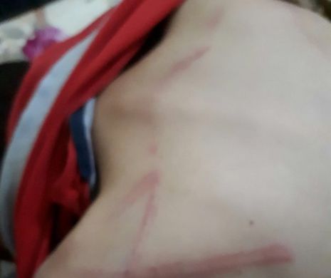 Copil aproape ucis în bătaie de către propriul tată. Ce a făcut mama