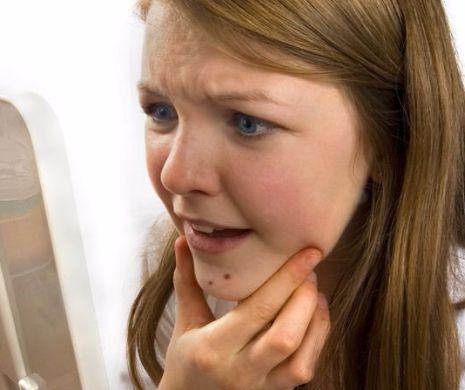 Cum scapi de acnee cu suc de struguri. Tratamentul AICI