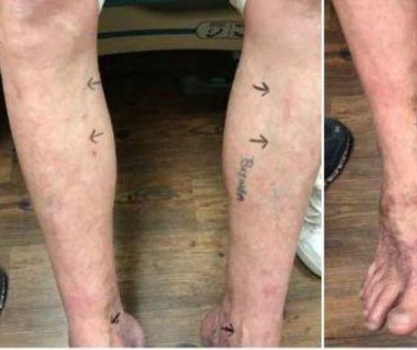 Un  condamnat la MOARTE cu INJECŢIA LETALĂ a SCĂPAT după două ore de chin