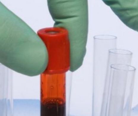 Alertă Europeană pentru imunoglobulină. Ministerul Sănătății în război cu producătorii