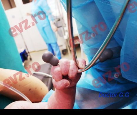 A prins stetoscopul medicului încă din prima secundă în care a venit pe lume!