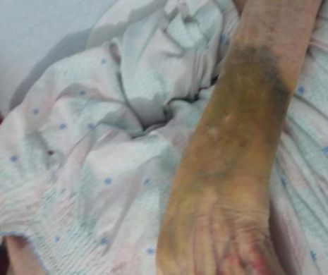 Acuzații grave la un azil de bătrâni: pacientă luată la palme de infirmieră