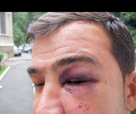 Un bărbat a  fost bătut pentru un motiv șocant! A intrebat cât costă o bicicletă aflată la vânzare!