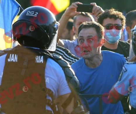 ULTIMA ORĂ! APEL către CETĂȚENII răniți în urma conflictelor din STRADĂ. Parchetul MILITAR îi cheamă să DEPUNĂ PLÂNGERI