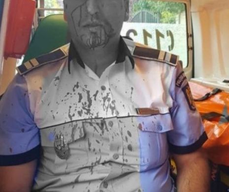 Un polițist a încercat să oprească un șofer, a tras focuri de armă și-a ajuns la URGENȚĂ plin de SÂNGE