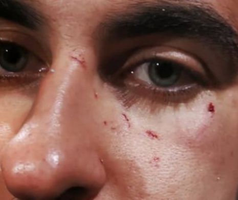 Pisa: Pereche de gay bătută şi insultată
