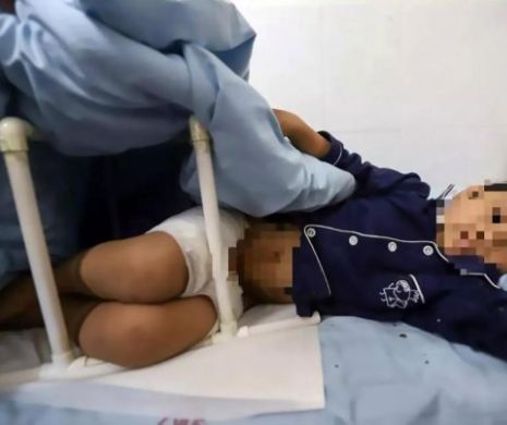 Mamă vitregă-monstru, torturează un copil de 7 ani arzându-i organele genitale
