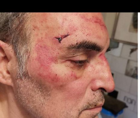 Agresiune homofobă într-o clădire de locuințe: Ești gay, te omorâm!