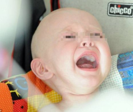 Anual, în România, 400 de copii sunt diagnosticaţi cu cancer
