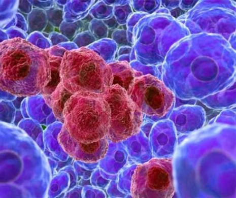 Tratament care poate să vindece complet CANCERUL. Studiu de ultimă oră
