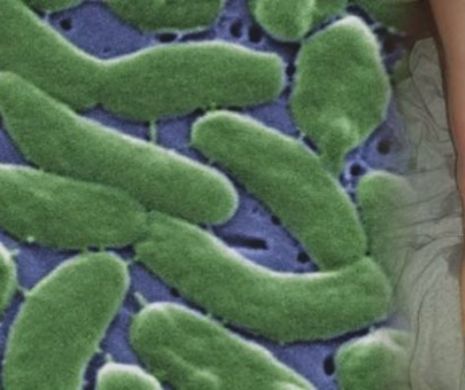 Avertisment! Plaje invadate de bacterii carnivore: Produc o infecţie, mâncând literalmente ţesuturile corpului uman