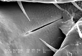 Congresul SUA investighează posibila armă biologică secretă a Pentagonului. Căpuşele?