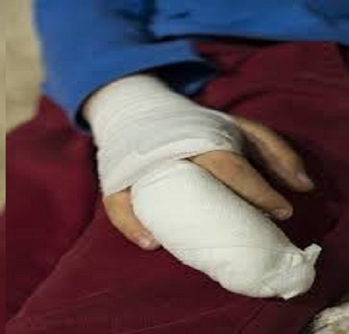 Teroare în Italia: o româncă a fost stropită cu acid, violată și mutilată