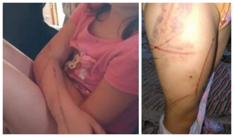 Scene înfiorătoare la Alba. Un tată şi-a bătut copiii cu biciul până au leşinat