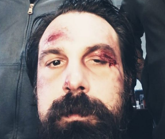 Un celebru actor din România, desfigurat în bătaie. Cum a ajuns la închisoare