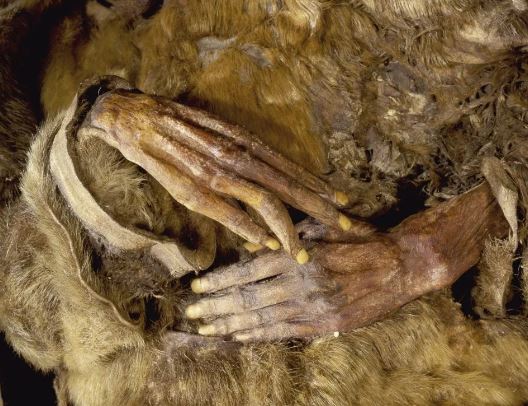 cadavru 2
