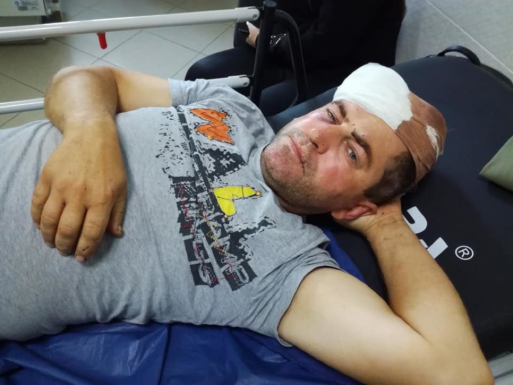 Politician snopit în bătaie. „Lumea este speriată, bine că nu l-au omorât”