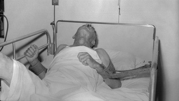 Boala care face ravagii în toată lumea cu excepția Antarcticii