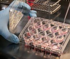 Medicii avertizează! Renunțați urgent la alimentul care răspândește cancerul în orgasnism