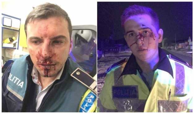 UPDATE. Care este situația polițiștilor bătuți cu sălbăticie. Intervenție de urgență