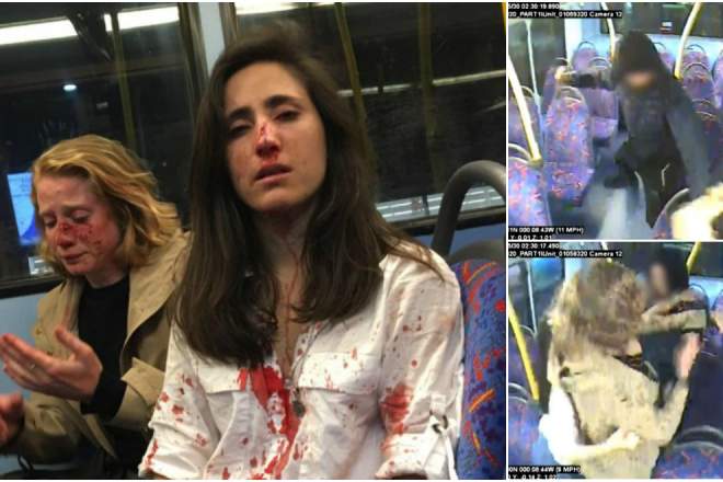 Trei minori au desfigurat în bătaie două fete într-un autobuz! Motivul este șocant