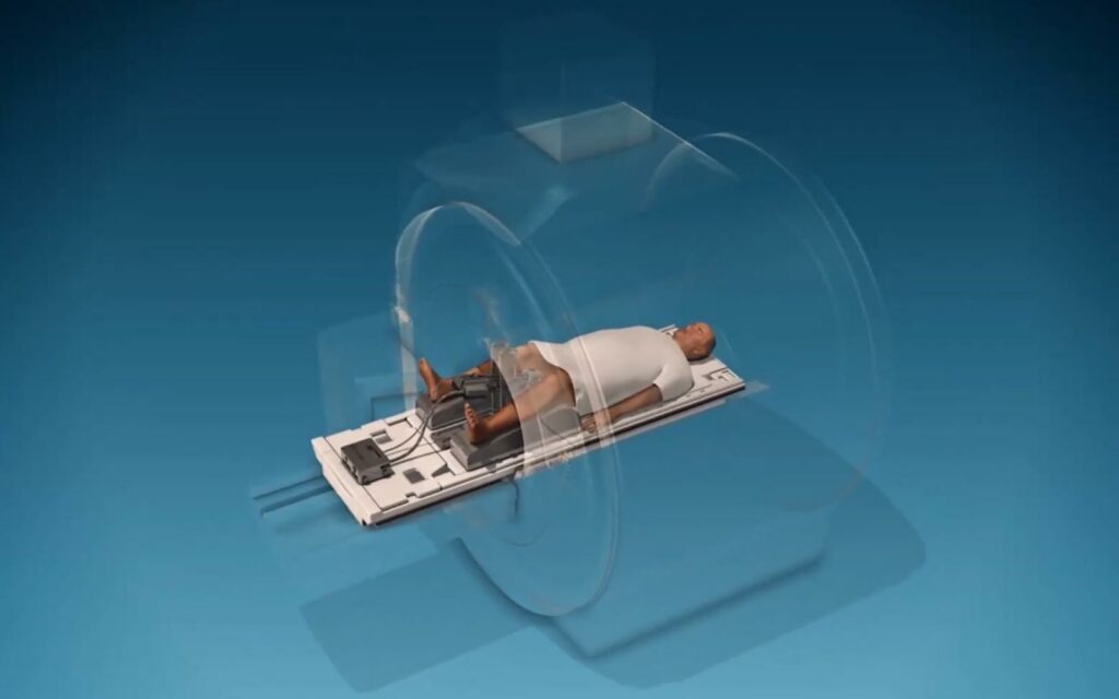 TULSA, tehnica inovativă care vindecă pacienții suferinzi de cancer de prostată!