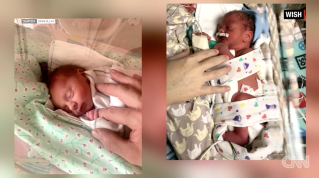 Gemeni de poveste. S-au născut zile, ani și în decenii diferite