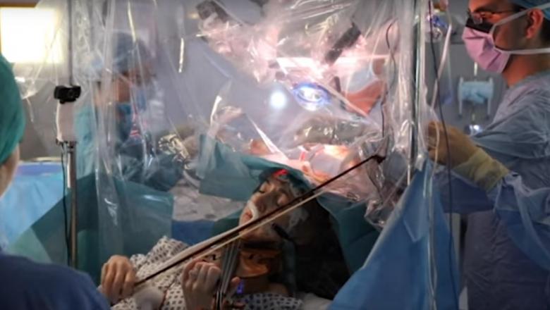 Experiment medical unic în lume. Pacientă operată pe creier în timp ce cânta la vioară