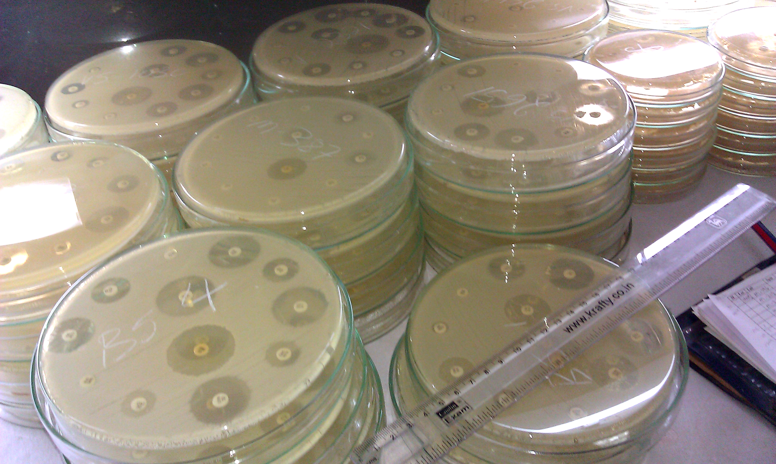 Sabia Covid-19. Fabricarea armelor biologice nu a fost niciodată mai ușoară