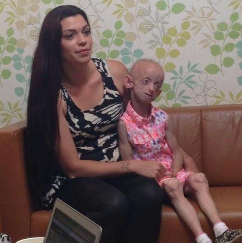 A trăit în realitate teribila dramă din filmul "Benjamin Button". Boala teribilă n-are leac deocamdată
