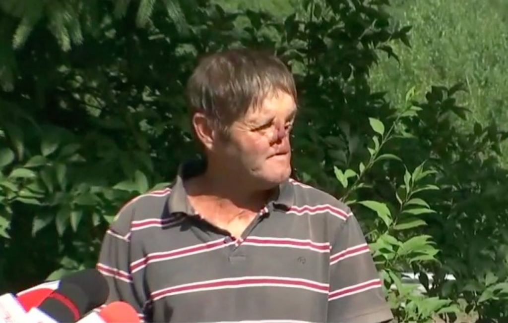 Întîlnirea cu ursul l-a transformat. Povestea tânărului desfigurat de un animal agresiv