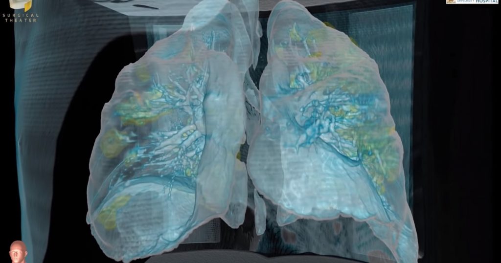 Alimentele care ajută la regenerarea plămânilor. Se găsesc în toate supermarketurile. Sfaturile specialiștilor