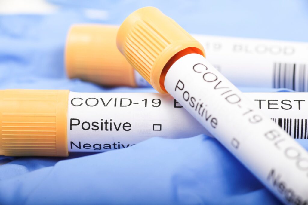 O mamă și-a bagat copilul infectat cu Covid în portbagaj