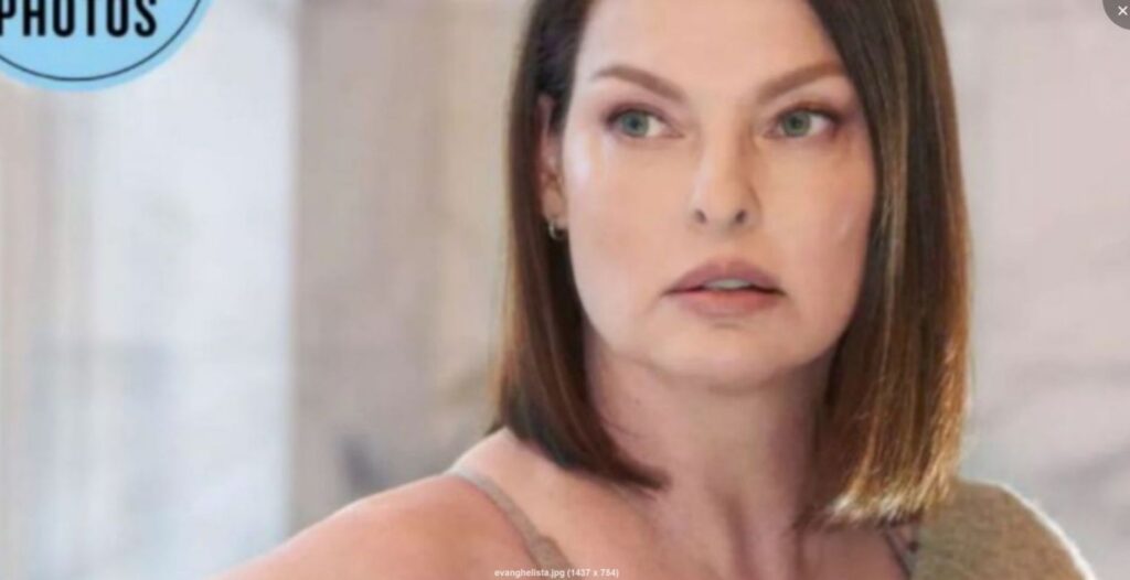 Primele imagini cu una dintre cele mai forografiate vedete din lume, distrusă de o operație estetică