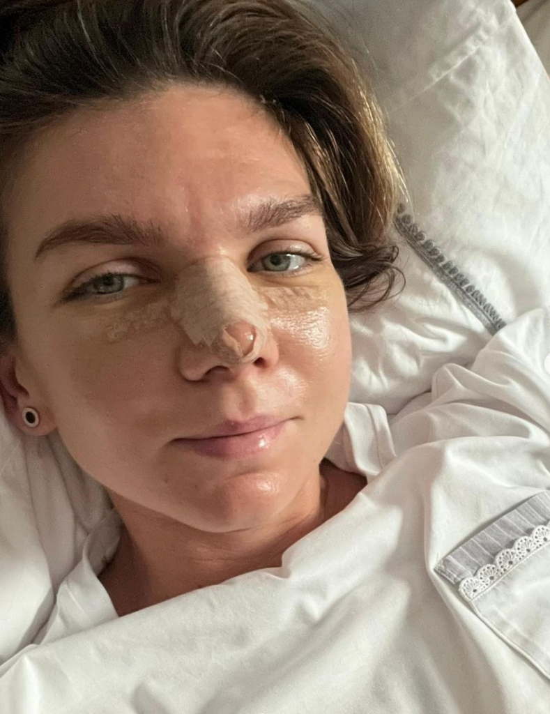 Simona Halep a ieșit din nou, după operația la nas. Unde a mers și ce ținută neobișnuită a purtat sportiva