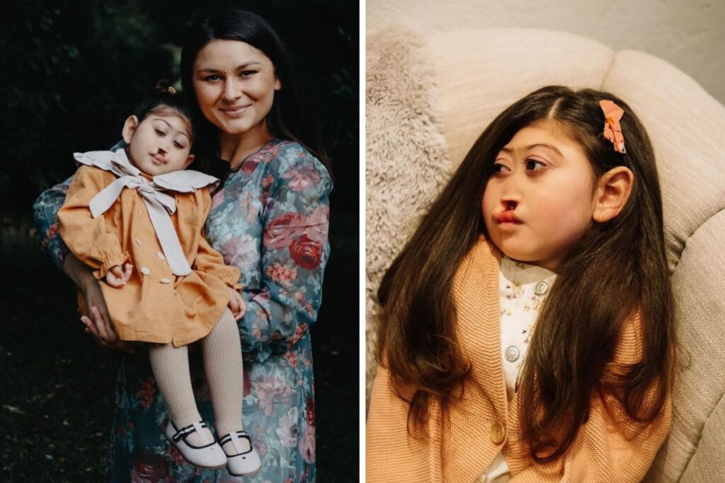 Mika Varga vorbește cu sufletul deschis despre fiica ei, Ruthie: „A trăit aproape patru ani. Am slujit un înger”