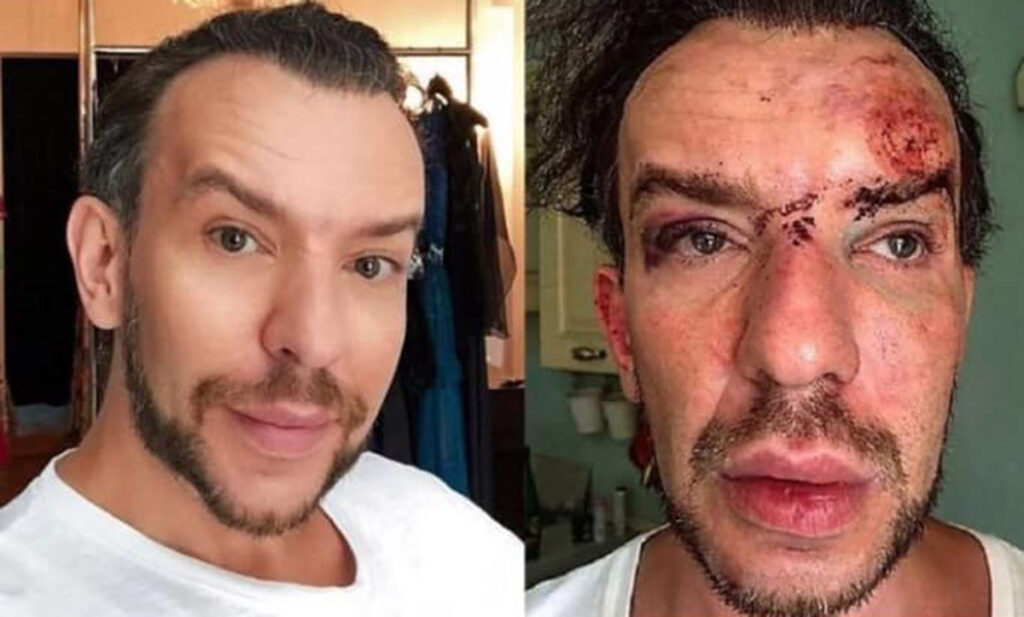 De aproape cinci ani, Stephan Pelger nu mai putea dormi noaptea. Problemele au apărut după ce a fost răpit, bătut cu bestialitate și jefuit