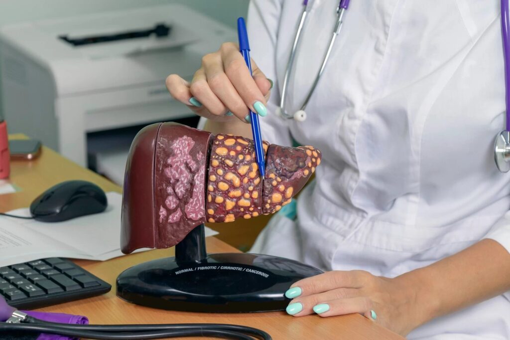 Simptomul ignorat de români care anunță un ficat bolnav. Cum putem să prevenim complicațiile